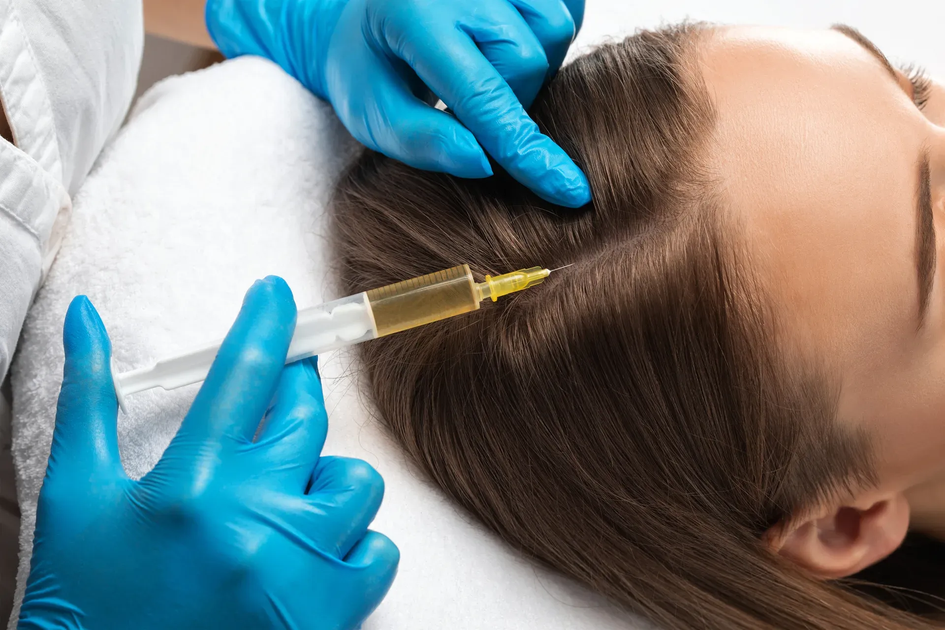 Hair Restoration in Los Angeles