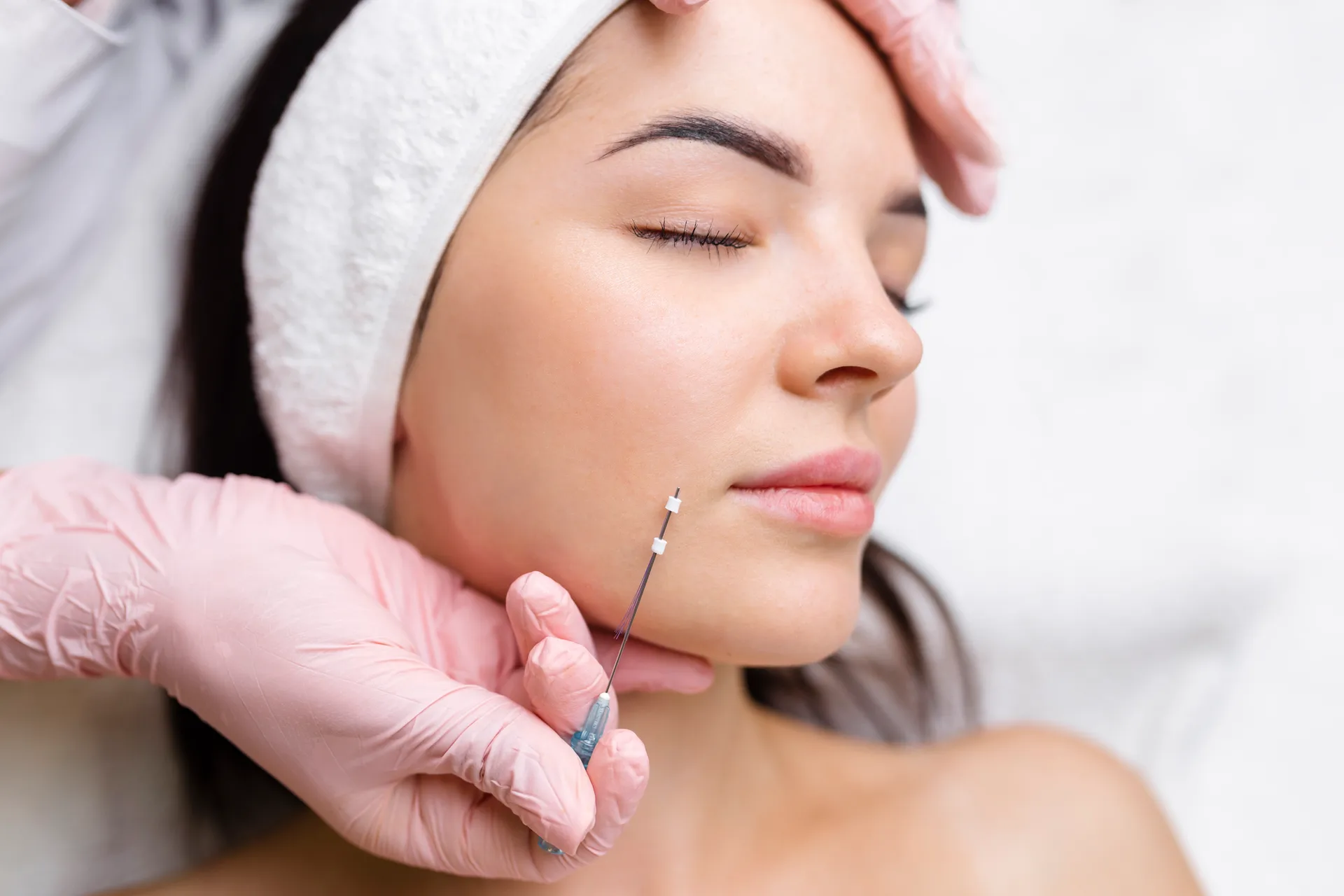 PDO Thread Lift in Los Angeles